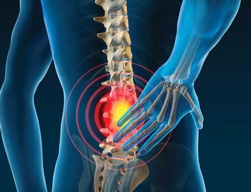 Low Back Pain