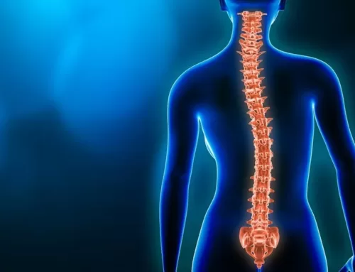 Scoliosis – Everything You Need to Know About This Condition