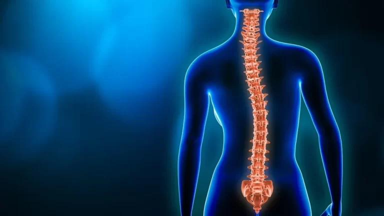 Scoliosis – Everything You Need to Know About This Condition