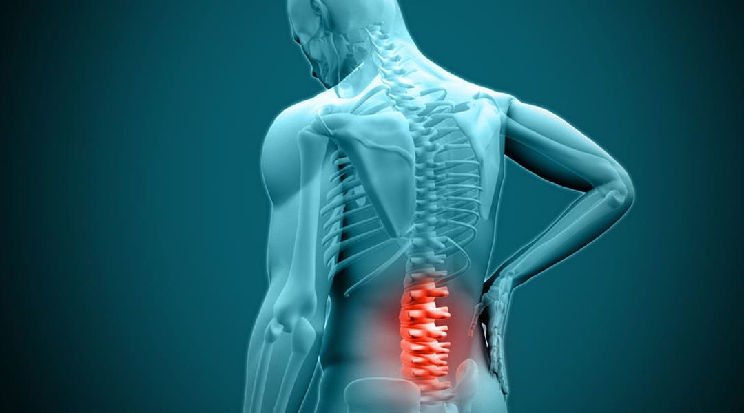 Herniated Disc Surgery – What You Need to Know