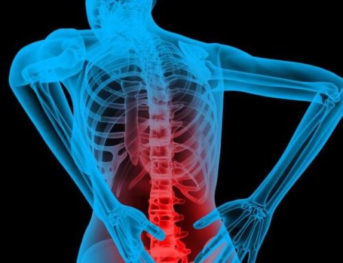 6 Common Causes of Back Pain and How to Prevent Them