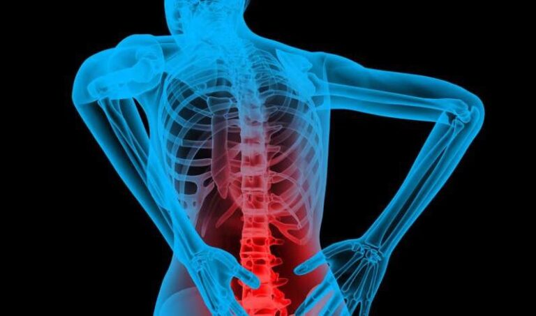 6 Common Causes of Back Pain and How to Prevent Them