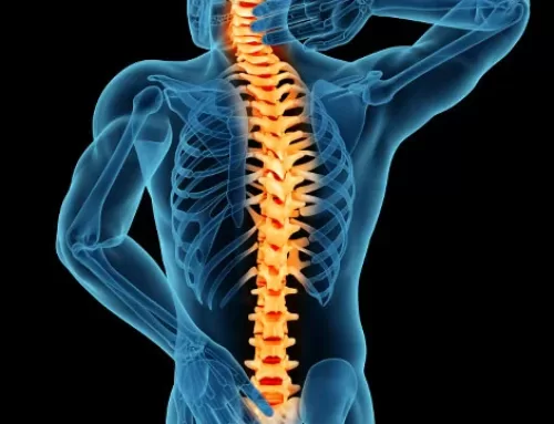 Spinal Stenosis: A Comprehensive Guide to Understanding and Managing the Condition