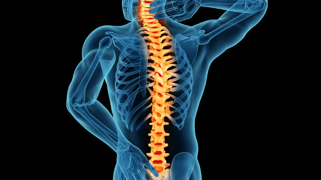 Spinal Stenosis: A Comprehensive Guide to Understanding and Managing the Condition