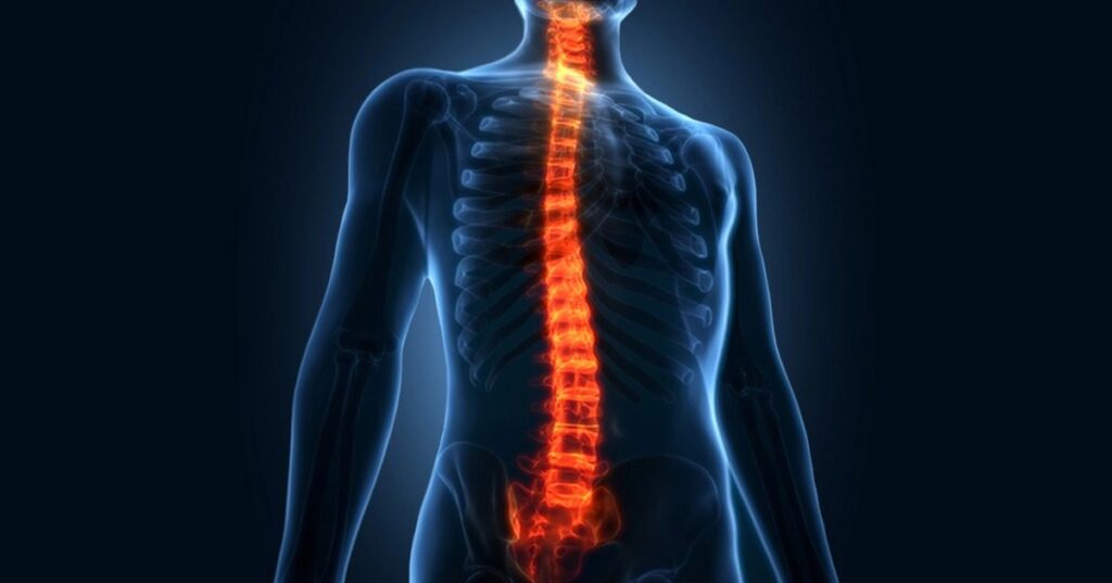 Understanding Slipped Disc: Causes, Symptoms, and Treatment