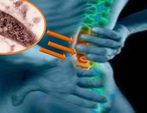Spinal Tuberculosis Symptoms: A Comprehensive Guide to Understanding Pott’s Disease
