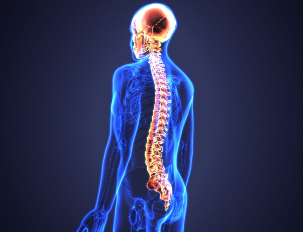 Spine Deformity Types, Causes, and Treatments Sattvik Spine Spine Surgeon