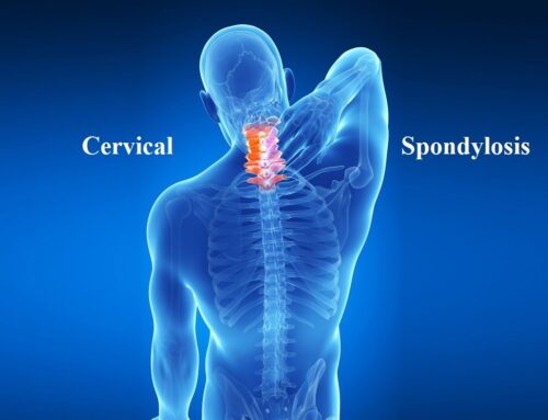 Understanding the Causes of Cervical Spondylosis: A Comprehensive Guide
