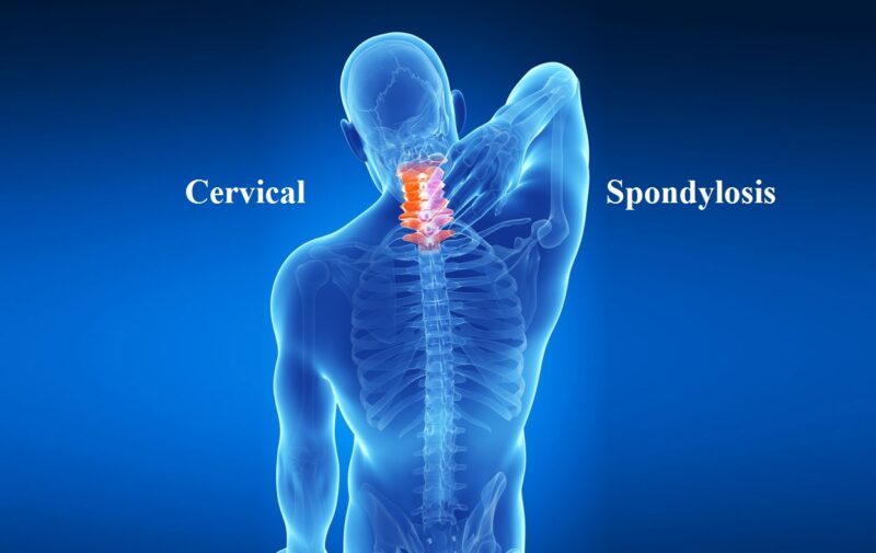 cervical spondylosis | Sattvik Spine | Spine Surgeon