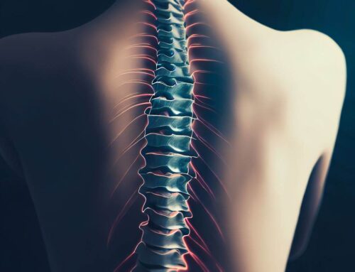 The Complete Guide to the Cost of Scoliosis Treatment In Bengaluru
