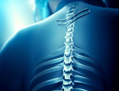 Slipped Disc Surgery Options and Recovery Process: Navigating Treatment and Healing