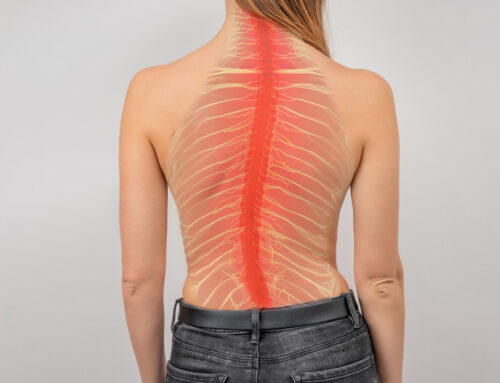 Scoliosis: Causes, Symptoms, Diagnosis, and Treatment Explained Simply